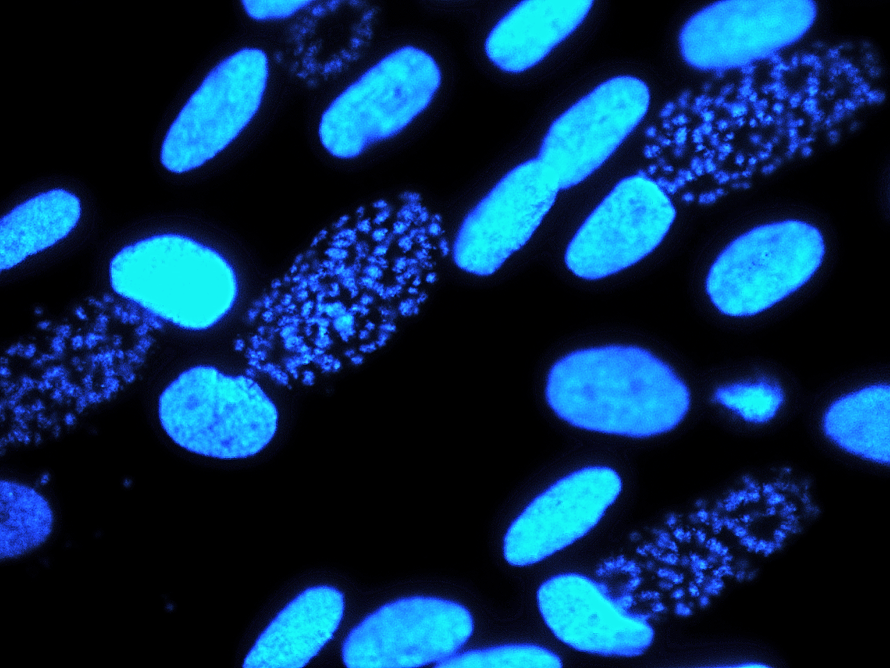 DNA staining  of Toxoplasma gondii parasites infecting human fibroblast monolayer cells. Photo credits to Eng Hwa 