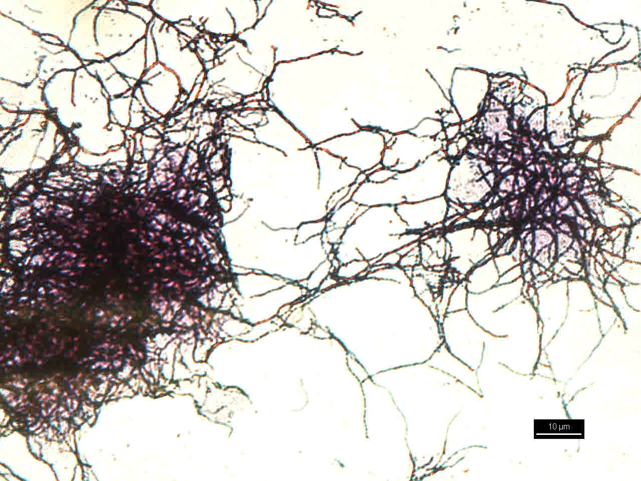 Actinomyces. Photo credits to Nurul
