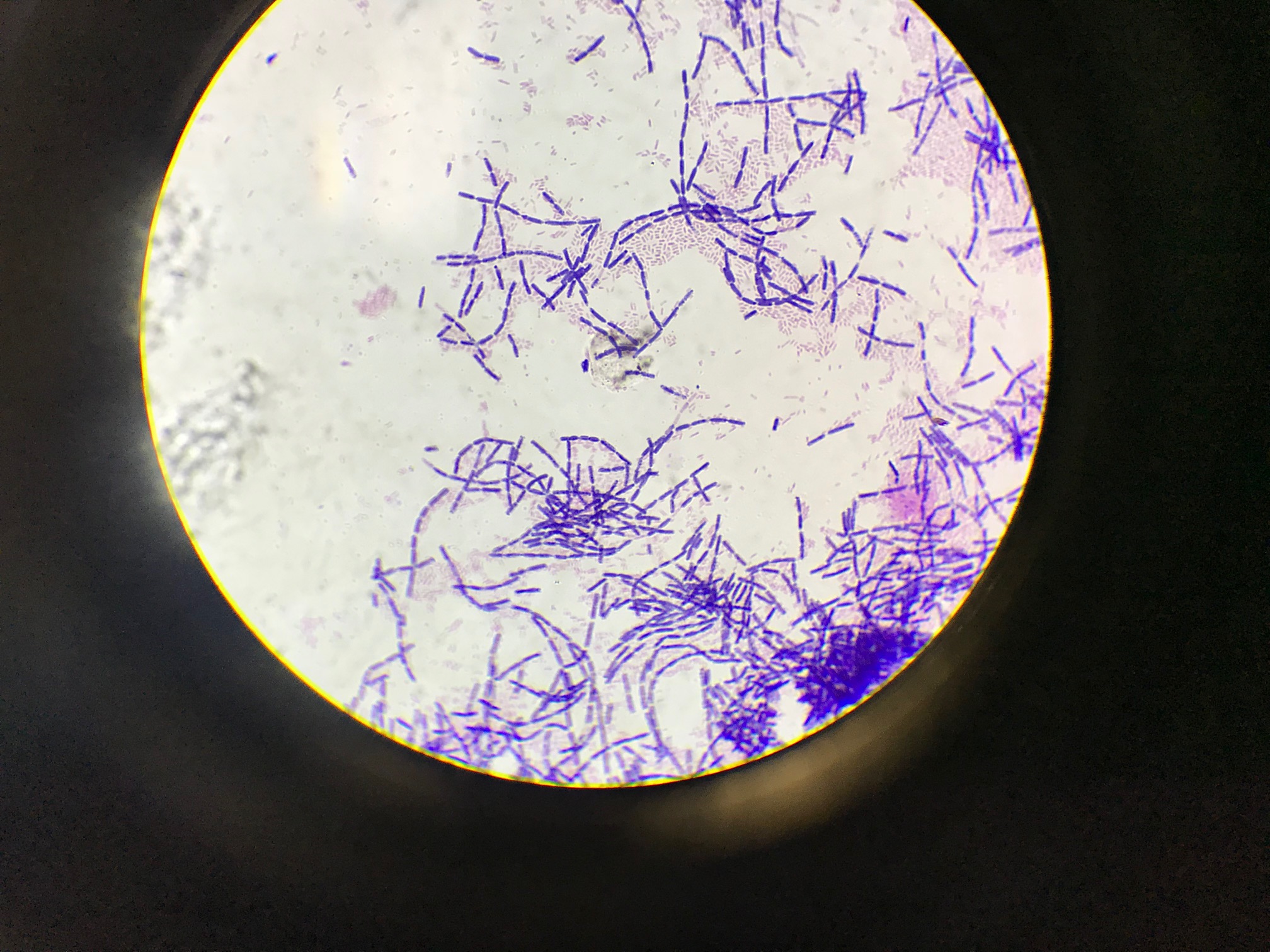 Bacillus gram staining. Photo credits to Calvin