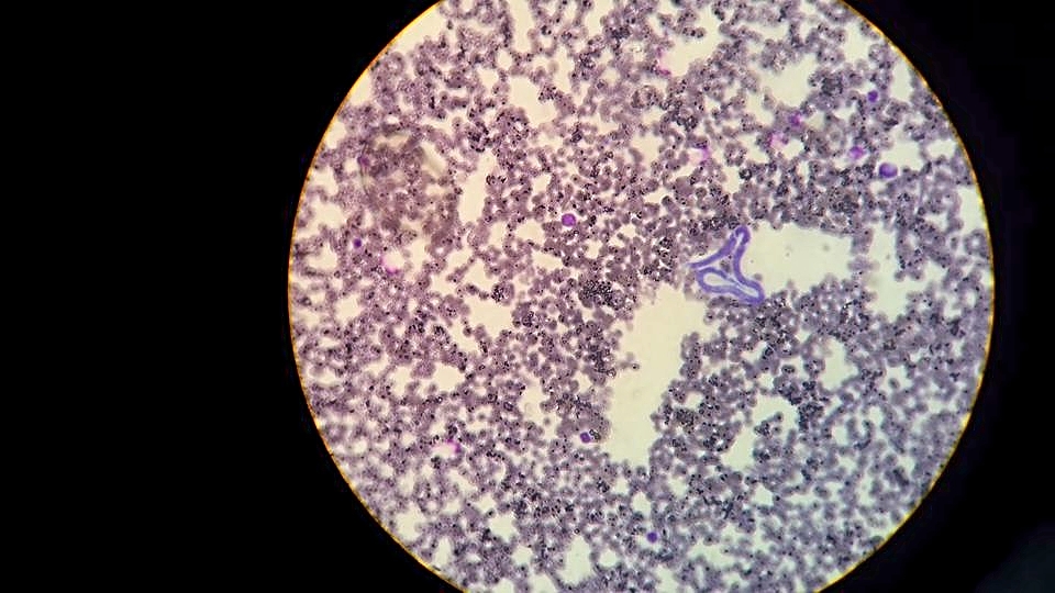 Microfilaria under microscope. Photo credits to Hon Fung