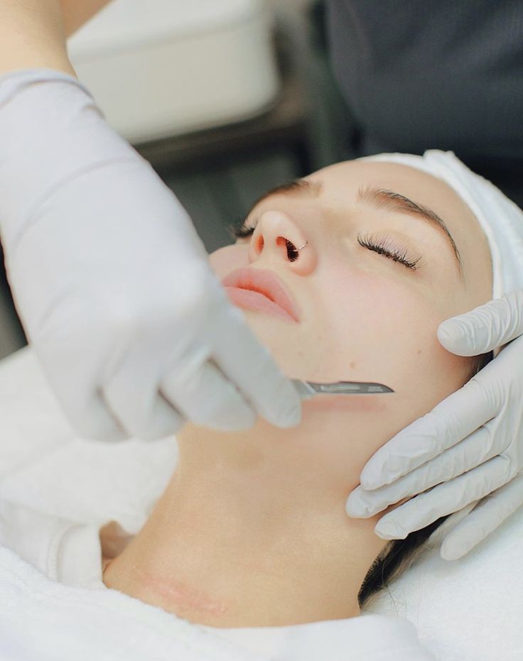 Dermaplaning 