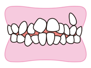 ”生理的でない噛み合わせが起こす不調"と"より健康になれる歯列矯正とは？"