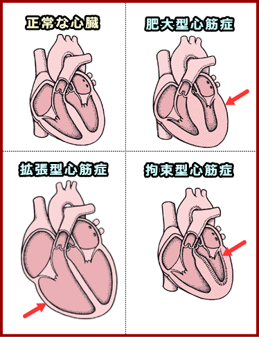 猫の心筋症の治療薬/長谷川動物病院