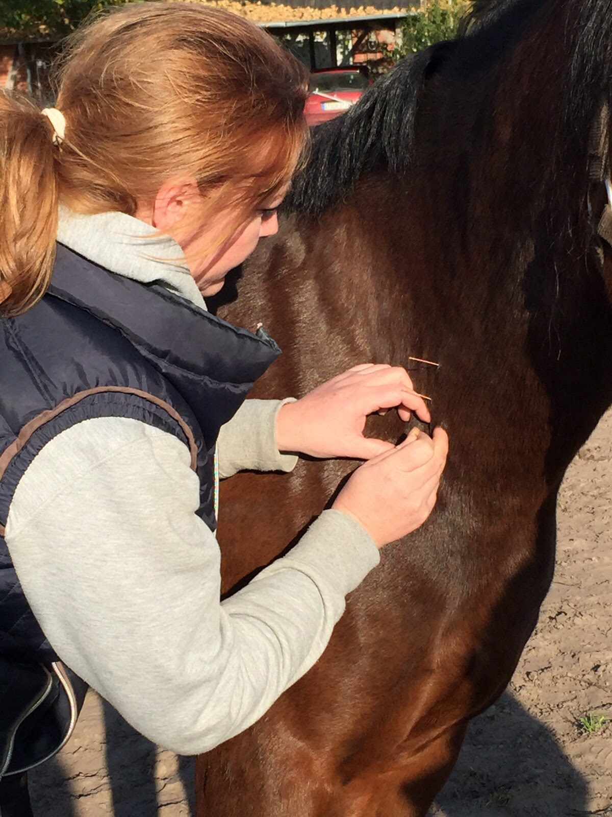 Dry Needling zur Lockerung der Halsmuskulatur