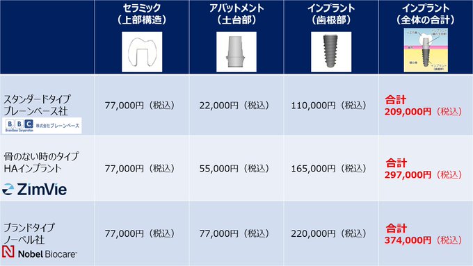 インプラントの失敗の保証について。