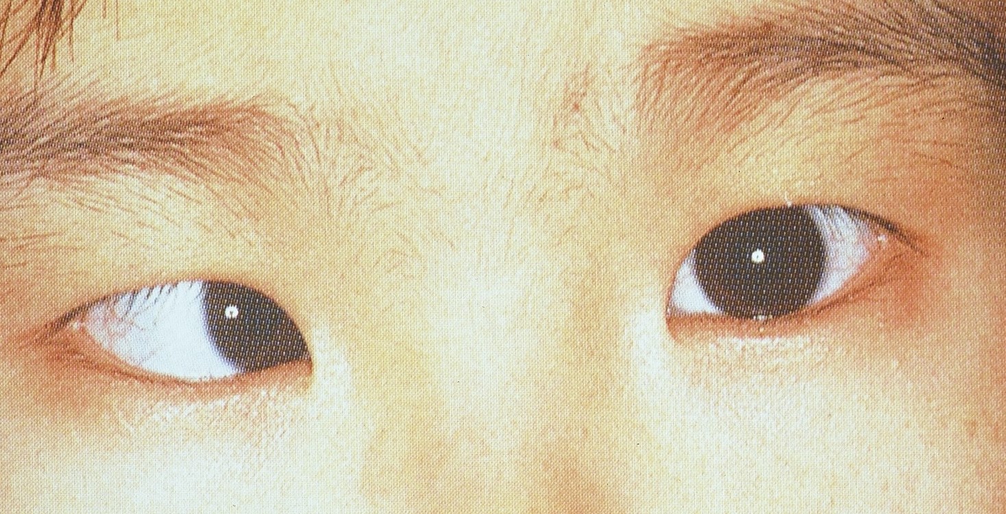 目 パチパチ 子供