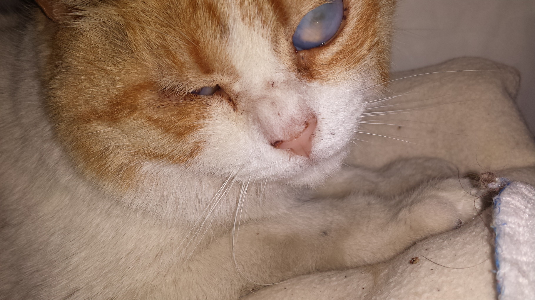 Simon antes de ser operado 