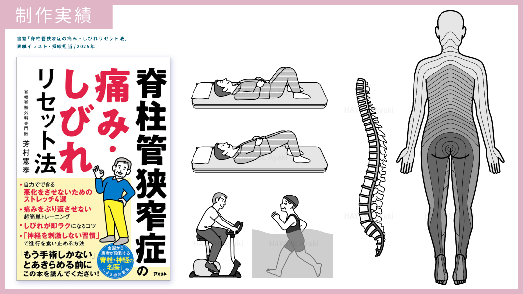 【お仕事情報】書籍「脊柱管狭窄症の痛み・しびれリセット法」カバーイラスト・挿絵