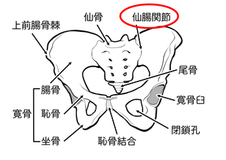 仙腸関節炎（仙腸関節機能障害）