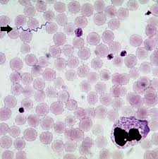 Borrelia miyamotoi