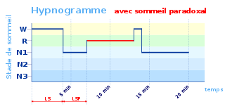 sommeil paradoxal