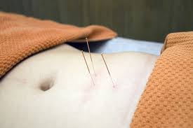 l'acupuncture fait des miracles