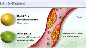 cholestérol