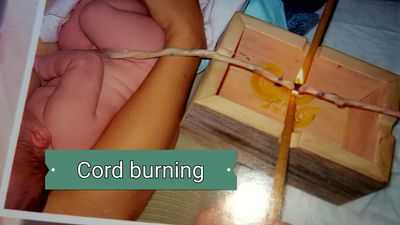 An amazing little cord burning box to safely sever the umbilical cord using two candle flames. (Picture by Marlene Waechter)