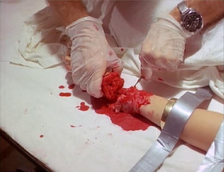 Doctor Gore (1972)