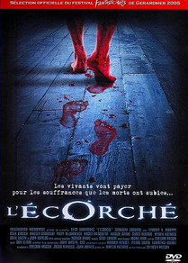 L'Ecorché