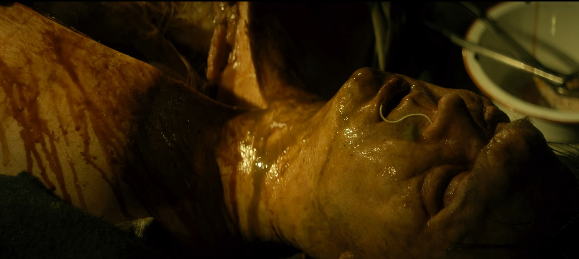 Trench 11 (2017) 