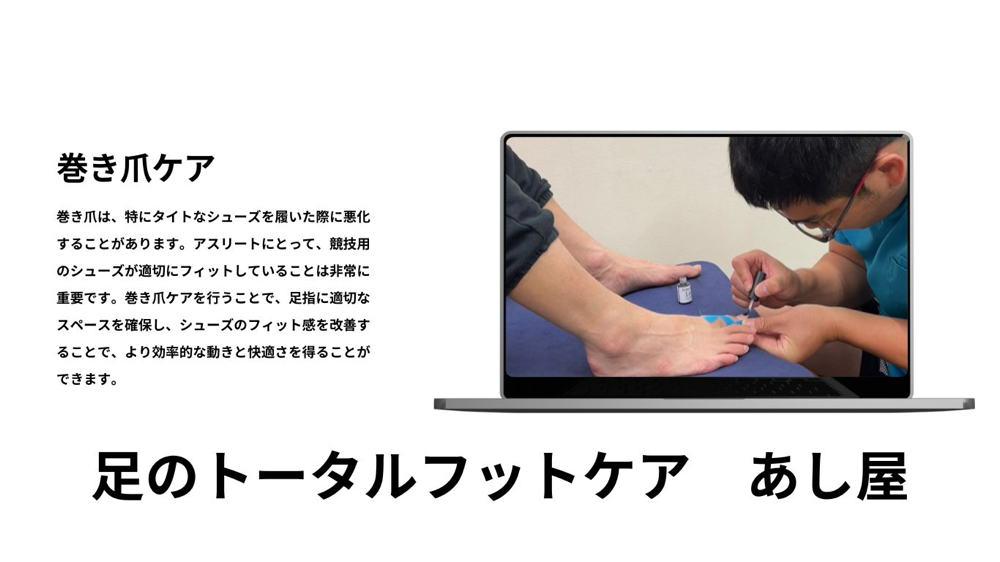 足のトータルフットケア　あし屋　巻き爪ケア
