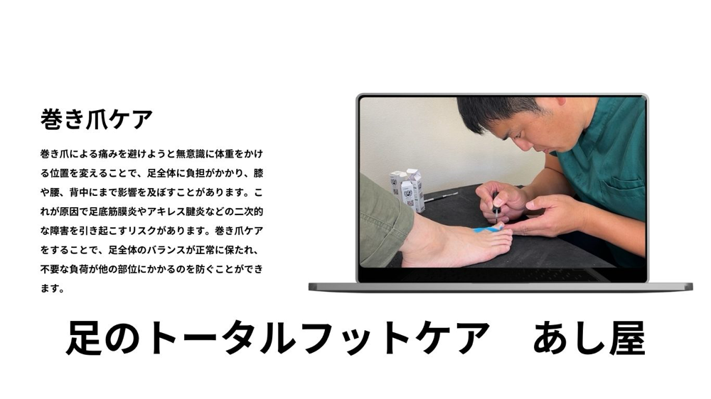 足のトータルフットケア　あし屋　岡山　巻き爪ケア
