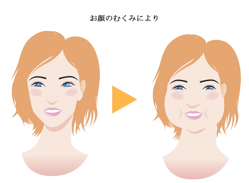 顔の たるみ むくみ 豊橋のたるみ改善専門サロン ポルト ボヌール