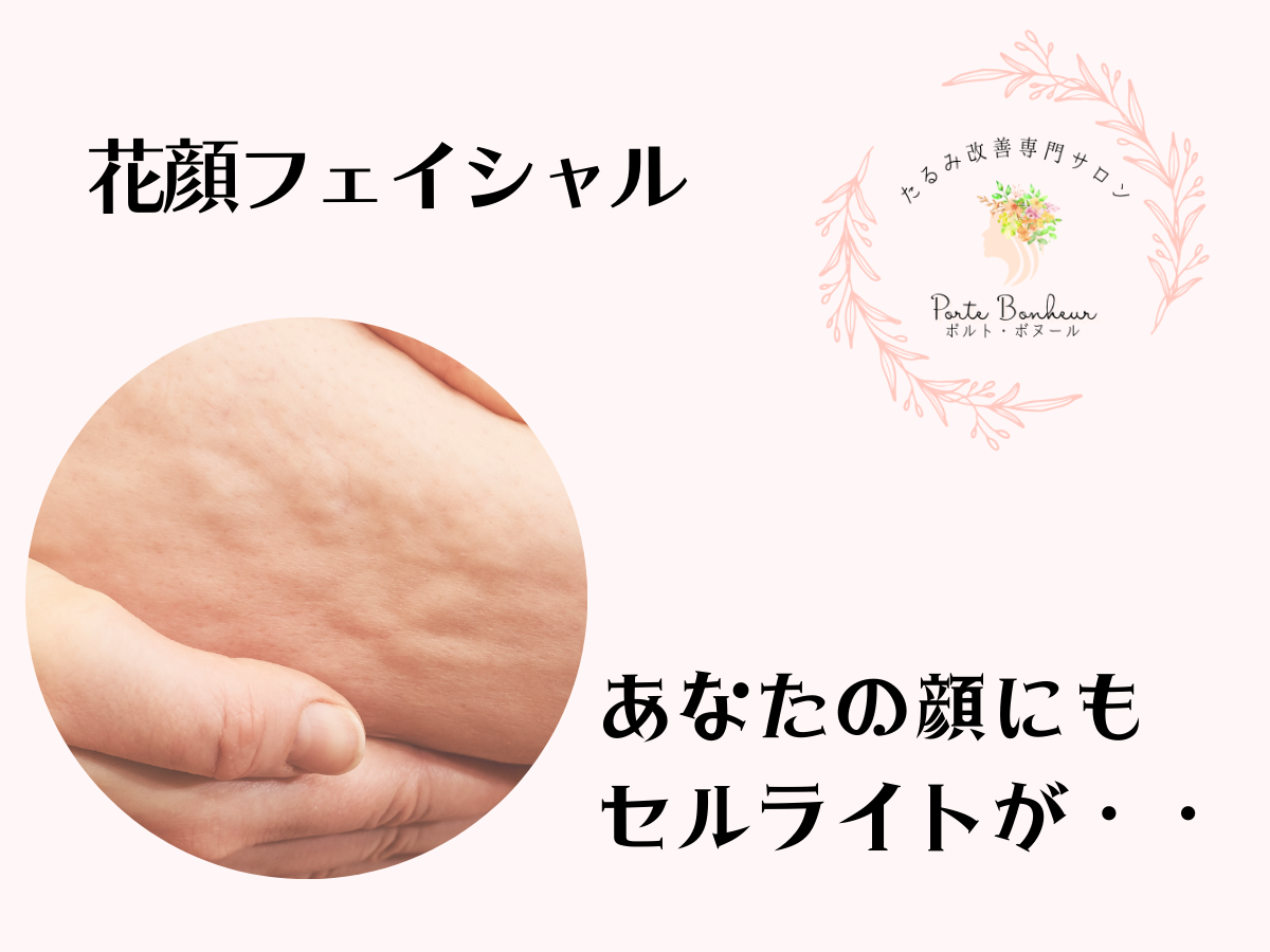 あなたの顔にもセルライトが・・