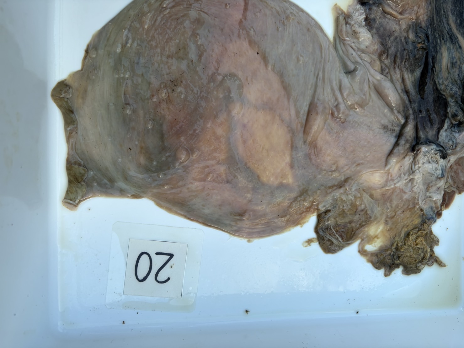 総排泄腔付近の大腸です。