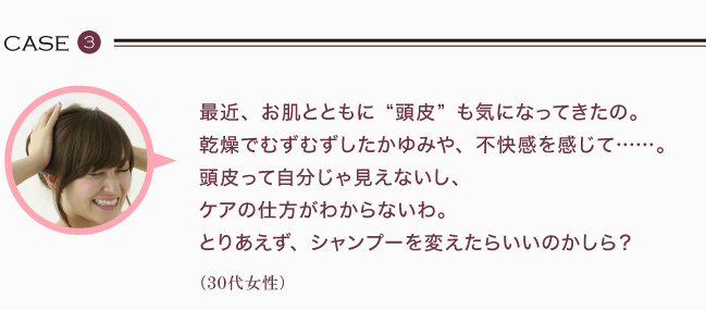 最近、お肌とともに“頭皮”も気になってきたの。 乾燥でむずむずしたかゆみや、不快感を感じて……。 頭皮って自分じゃ見えないし、 ケアの仕方がわからないわ。 とりあえず、シャンプーを変えたらいいのかしら？