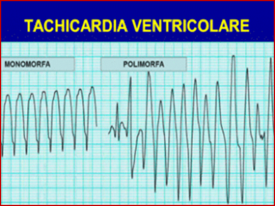 *Le aritmie cardiache - gennarino borrello