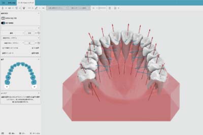 画像診断システム「Ortho Studio」