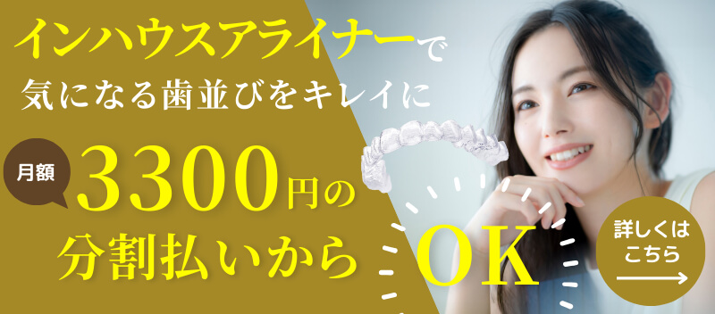インハウスアライナーで気になる歯並びをキレイに月額3,300円の分割払いからOK！　詳しくはこちら
