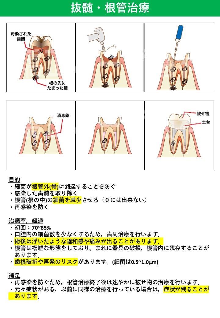根管治療(抜髄)