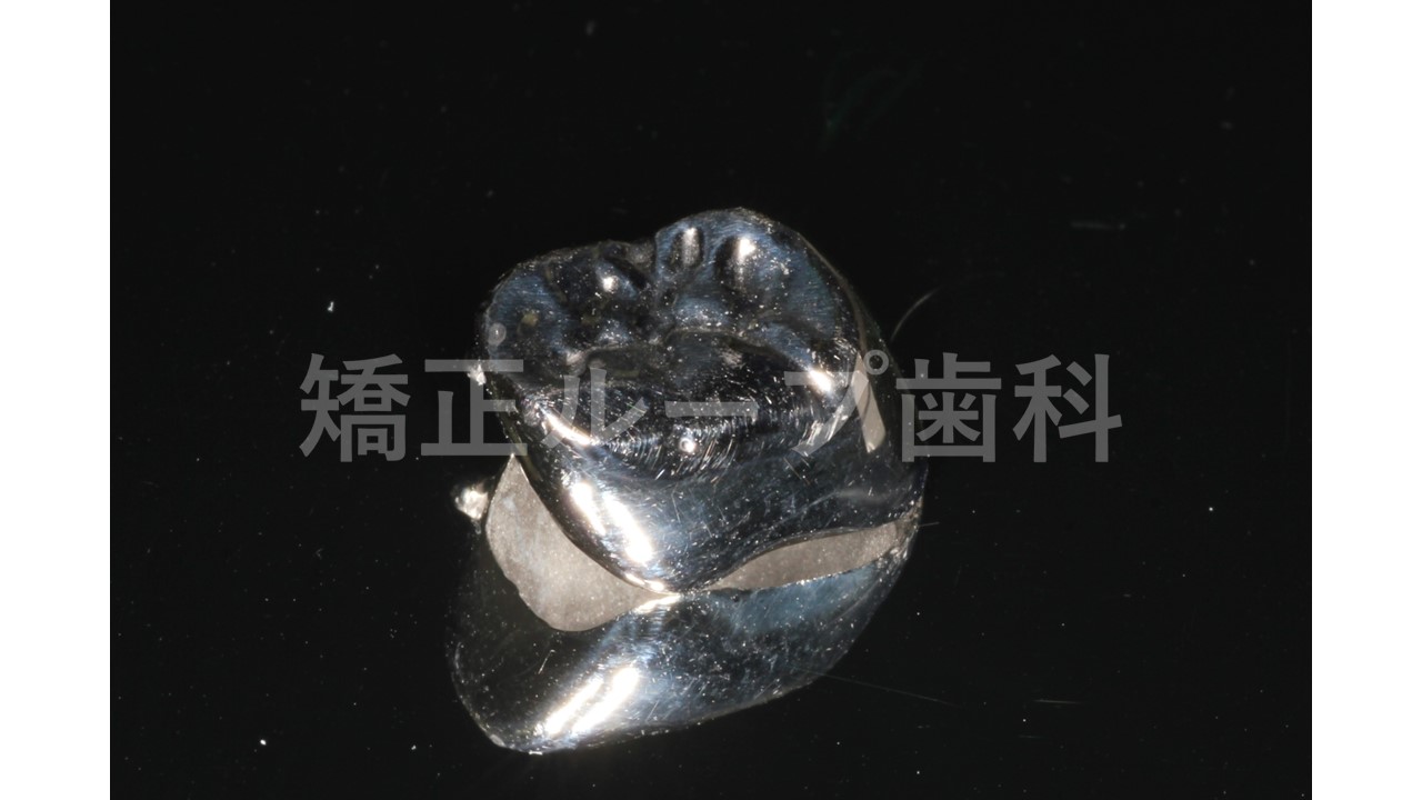 保険診療・金属冠