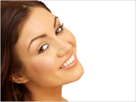 Veneers