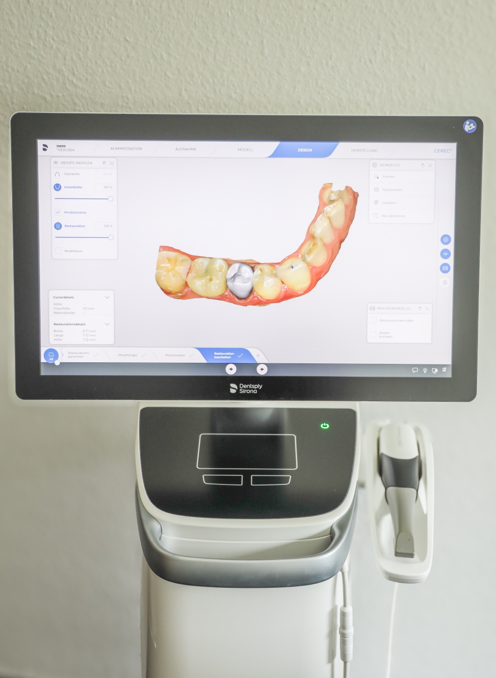 Cerec