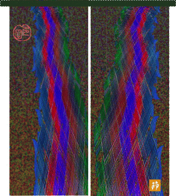 葉っぱで画像作成のアレンジ