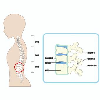 椎間関節痛の腰痛