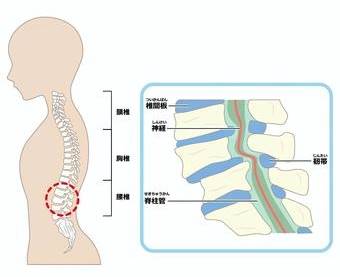 脊柱管狭窄症に対しての説明