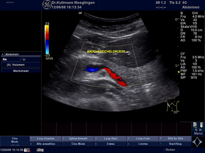 Bild der Bauchspeicheldrüse