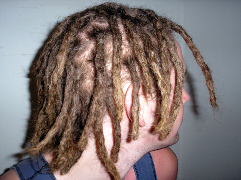 Why most dreadlock methods require extra work. 