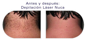Depilar pelos nuca mujer deals