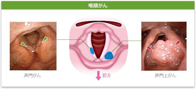 口腔・咽頭・喉頭・気管・食道 口腔、咽頭と喉頭 | 徹底的解剖学（かずひろ先生 解剖学）