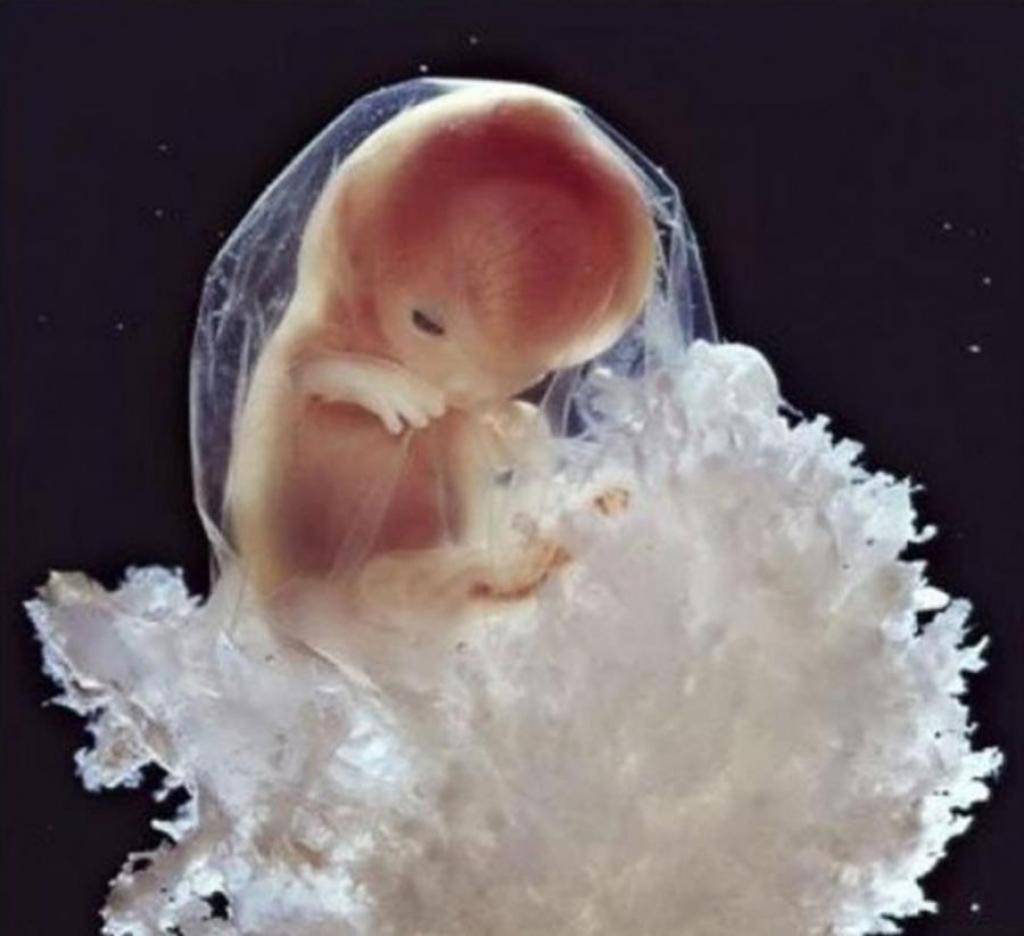 10 semaines de développement  Le fœtus commence à utiliser ses mains pour prendre connaissance de son environnement.