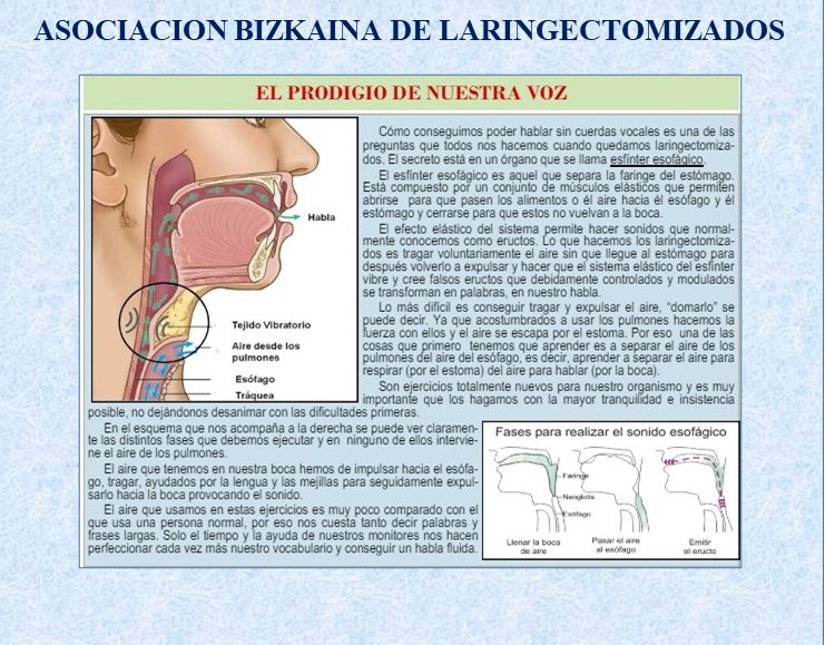 EL SECRETO  DEL "ESFINTER ESOFÁGICO"