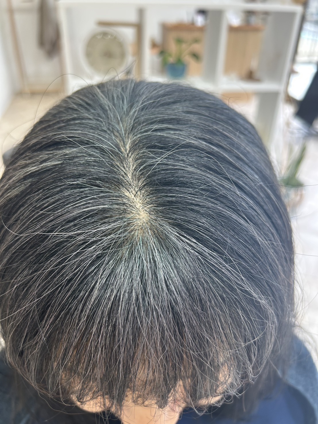 after：青緑に染まったところが24時間かけて変色していきます。