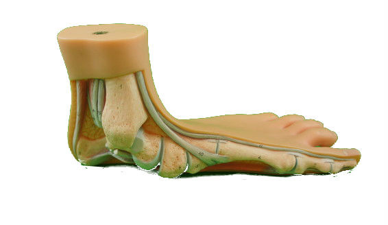 Fußmodell Plattfuß