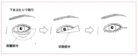 千葉の美容外科ならサンライズ美容外科へ