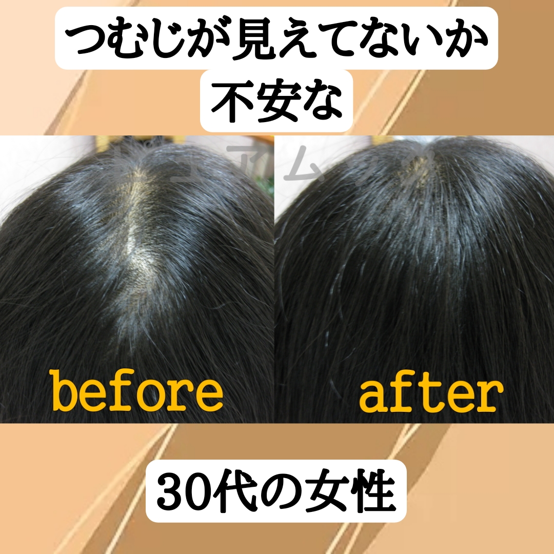つむじの悩み解決！エクステ増毛で毎朝、時短！