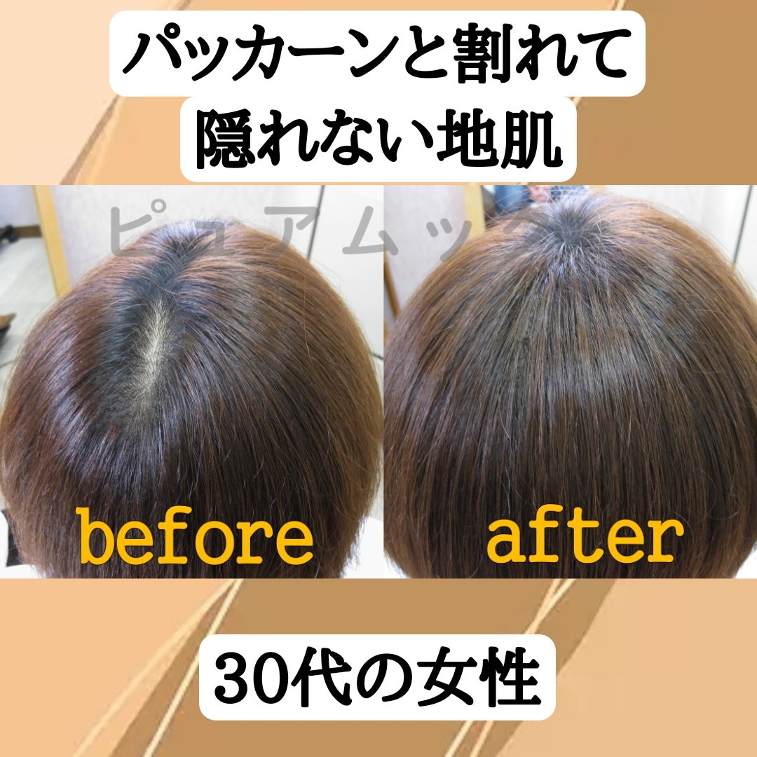 髪型の「コンプレックス」は増毛エクステで解消できる！