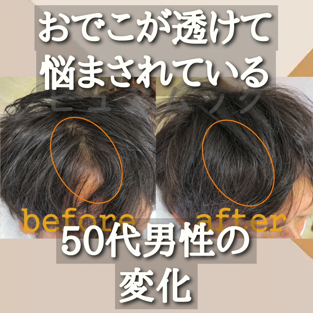 割れてしまう前髪。自然な前髪は増毛エクステで作る！
