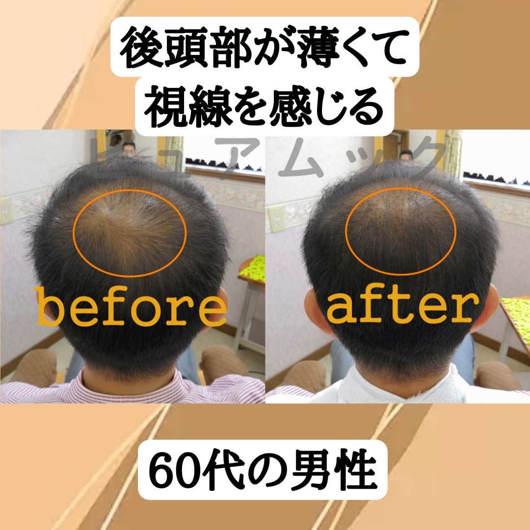 後頭部が薄くて視線を感じる60代男性